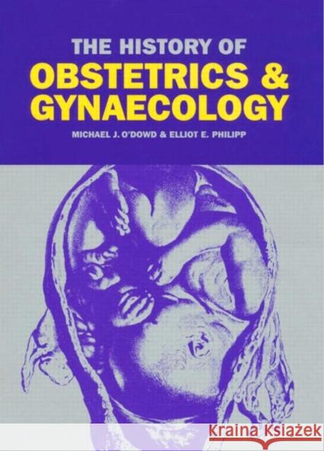 The History of Obstetrics and Gynaecology M. J. O'Dowd E. E. Philipp Michael J. O'Dowd 9781850700401 Taylor & Francis Group - książka