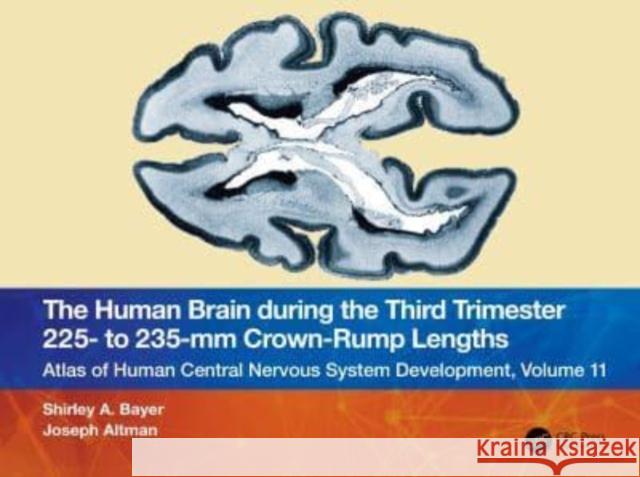 The Human Brain during the Third Trimester 225- to 235-mm Crown-Rump Lengths Joseph (Indianapolis, Indiana, USA) Altman 9781032220048 Taylor & Francis Ltd - książka