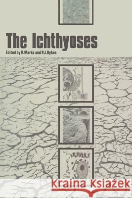 The Ichthyoses: Proceedings of the 2nd Annual Clinically Orientated Symposium of the European Society for Dermatological Research Marks, R. 9789401098533 Springer - książka