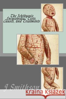 The Ichthyosis Encycopedia: Tests, Causes, and Treatments J. P. Smithso M. Awa 9781467926980 Createspace - książka