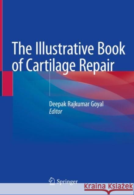 The Illustrative Book of Cartilage Repair Deepak Rajkumar Goyal 9783030471538 Springer - książka