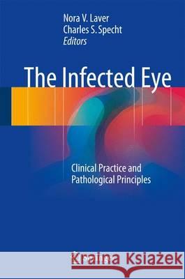 The Infected Eye: Clinical Practice and Pathological Principles Laver, Nora V. 9783319428383 Springer - książka