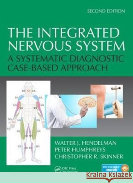 The Integrated Nervous System: A Systematic Diagnostic Case-Based Approach, Second Edition Walter Hendelma Christopher R. Skinner Peter Humphreys 9781138037427 CRC Press - książka