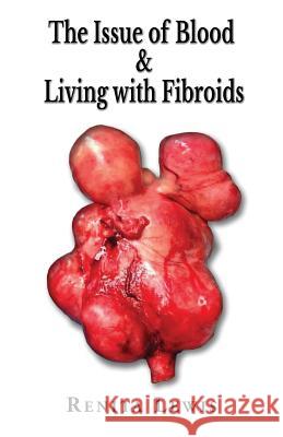 The Issue Of Blood & Living with Fibroids Lewis, Renita 9780997745108 Premium Publications - książka