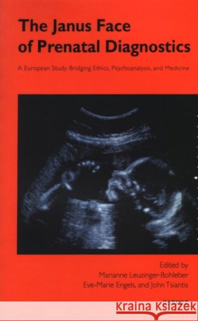 The Janus Face of Prenatal Diagnosis: A European Study Bridging Ethics, Psychoanalysis, and Medicine Marianne Leuzinger-Bohleber 9781855756748 Karnac Books - książka