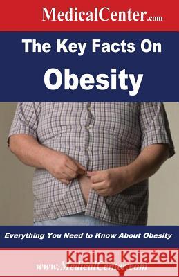 The Key Facts on Obesity: Everything You Need to Know About Obesity Nee, Patrick W. 9781490522838 Createspace - książka