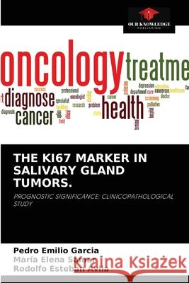 The Ki67 Marker in Salivary Gland Tumors. Pedro Emilio Garcia, María Elena Samar, Rodolfo Esteban Avila 9786204047638 Our Knowledge Publishing - książka