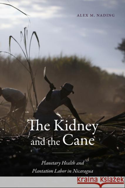 The Kidney and the Cane: Planetary Health and Plantation Labor in Nicaragua Alex M. Nading 9781478028666 Duke University Press - książka