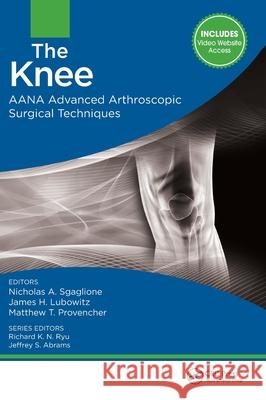 The Knee: Aana Advanced Arthroscopic Surgical Techniques Nicholas A. Sgaglione James H. Lubowitz Matthew Provencher 9781617119996 Slack - książka