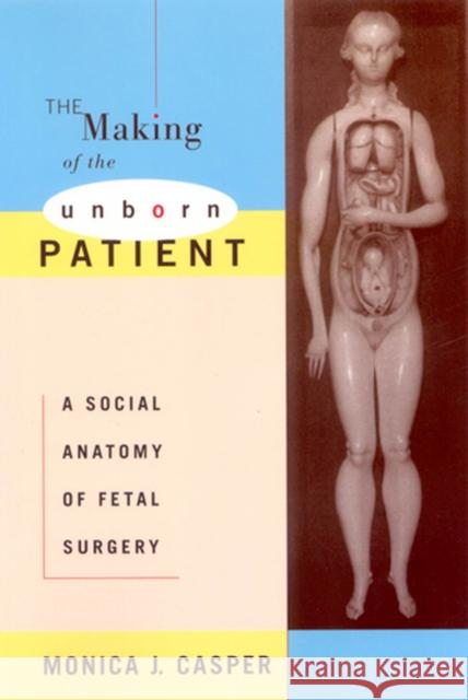 The Making of the Unborn Patient: A Social Anatomy of Fetal Surgery Casper, Monica J. 9780813525167 Rutgers University Press - książka