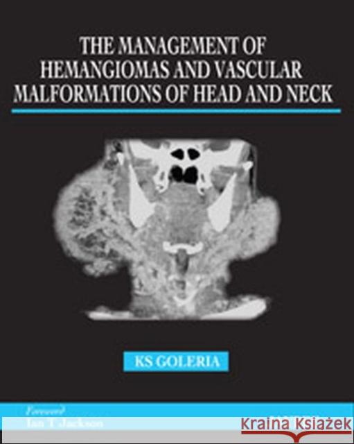 The Management of Haemangiomas and Vascular Malformations of Head and Neck K S Goleria 9789350251256  - książka