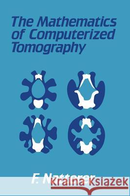 The Mathematics of Computerized Tomography F. Natterer 9783519021032 Vieweg+teubner Verlag - książka