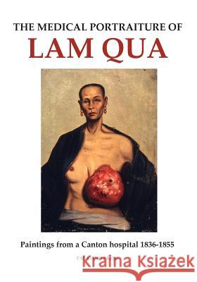 The Medical Portraiture of Lam Qua: Paintings from a Canton hospital 1836-1855 Palatino Press 9781497391246 Createspace - książka