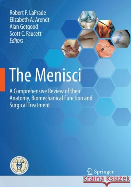 The Menisci: A Comprehensive Review of Their Anatomy, Biomechanical Function and Surgical Treatment Laprade, Robert F. 9783662571606 Springer - książka