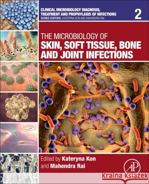 The Microbiology of Skin, Soft Tissue, Bone and Joint Infections: Volume 2 Kon, Kateryna 9780128110799 Academic Press - książka