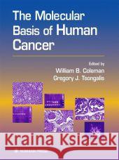 The Molecular Basis of Human Cancer William B. Coleman Gregory J. Tsongalis 9781617371073 Springer - książka