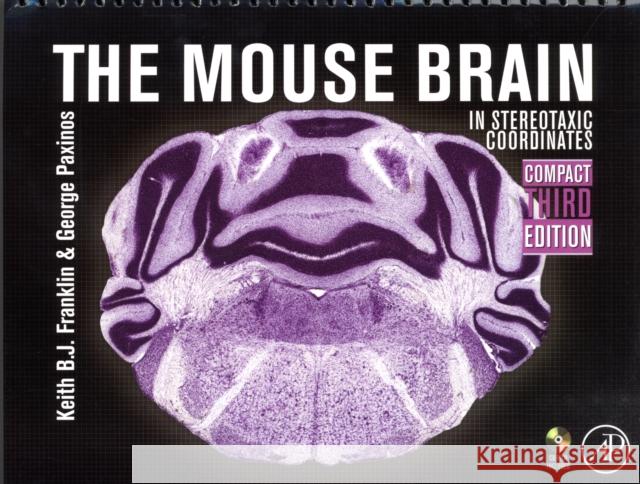 The Mouse Brain in Stereotaxic Coordinates, Compact: The Coronal Plates and Diagrams [With CDROM] Franklin, Keith B. J. 9780123742445 Academic Press - książka