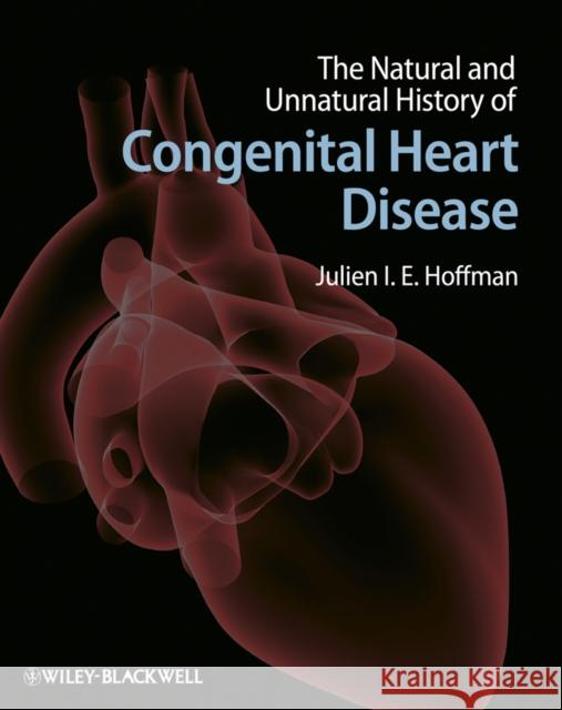 The Natural and Unnatural History of Congenital Heart Disease Julien Hoffman 9781405179270 JOHN WILEY AND SONS LTD - książka