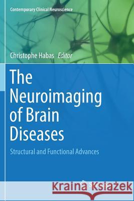 The Neuroimaging of Brain Diseases: Structural and Functional Advances Habas, Christophe 9783030076818 Springer - książka
