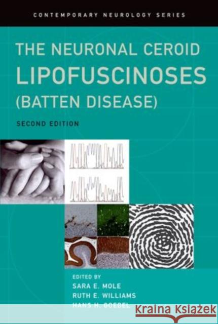 The Neuronal Ceroid Lipofuscinoses (Batten Disease) Sara Mole Ruth Williams Hans Goebel 9780199590018 Oxford University Press - książka