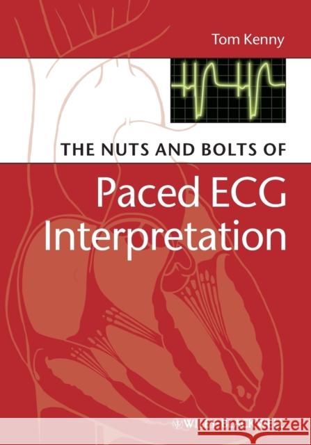 The Nuts and Bolts of Paced ECG Interpretation Kenny, Tom 9781405184045 Wiley-Blackwell - książka