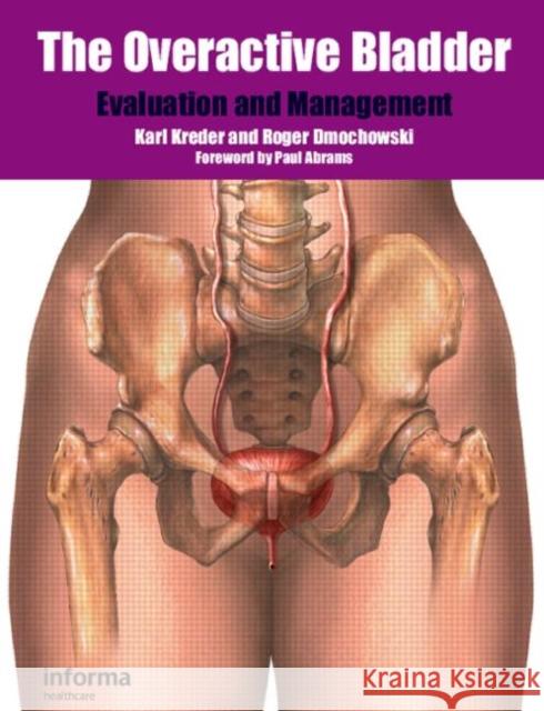 The Overactive Bladder: Evaluation and Management Kreder, Karl 9781841846309 Informa Healthcare - książka