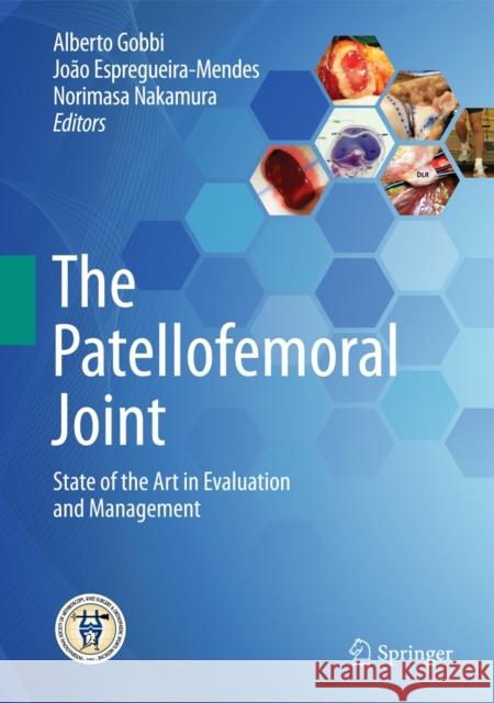 The Patellofemoral Joint: State of the Art in Evaluation and Management Gobbi, Alberto 9783642549649 Springer - książka