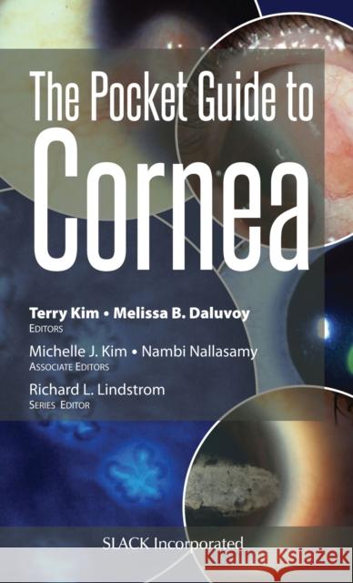 The Pocket Guide to Cornea Terry Kim Melissa Daluvoy 9781630914189 Slack - książka