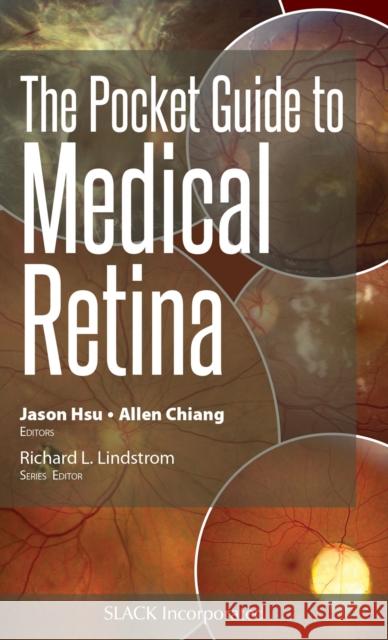 The Pocket Guide to Medical Retina J. Hsu 9781630916329 Slack - książka