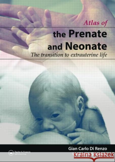The Prenate and Neonate: An Illustrated Guide to the Transition to Extrauterine Life Di Renzo, Gian Carlo 9781842140444 Informa Healthcare - książka
