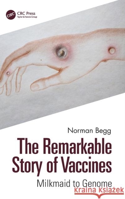 The Remarkable Story of Vaccines: Milkmaid to Genome Norman Begg 9781032301983 CRC Press - książka