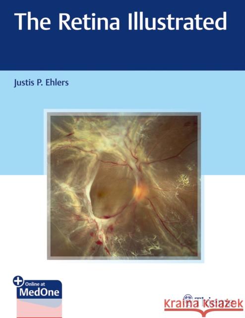 The Retina Illustrated Ehlers, Justis P. 9781626238312 Thieme Medical Publishers - książka