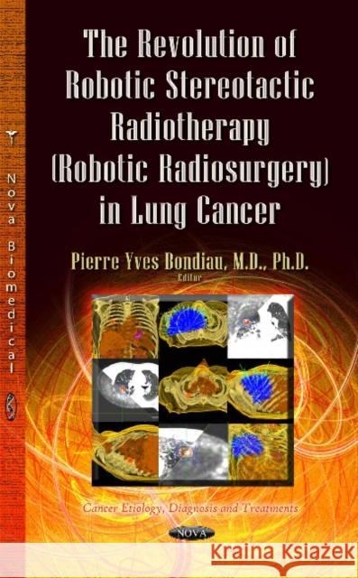 The Revolution of Robotic Stereotactic Radiotherapy (Robotic Radiosurgery) in Lung Cancer Pierre-Yves Bondiau 9781628087185 Nova Science Publishers Inc - książka