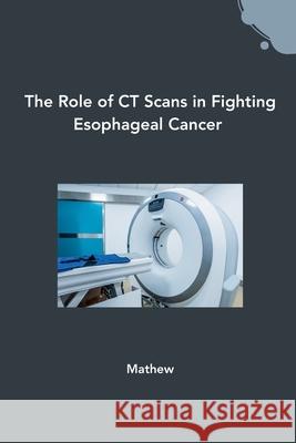 The Role of CT Scans in Fighting Esophageal Cancer Mathew 9783384243188 Tredition Gmbh - książka