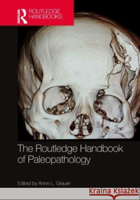 The Routledge Handbook of Paleopathology  9780367640675 Taylor & Francis Ltd - książka