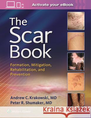 The Scar Book: Formation, Mitigation, Rehabilitation and Prevention Krakowski, Andrew C. 9781496322388 LWW - książka