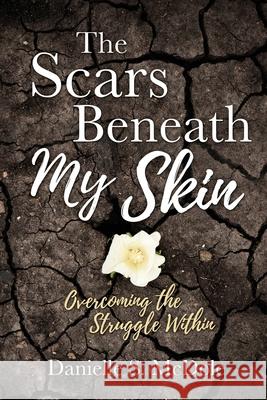 The Scars Beneath My Skin: Overcoming the Struggle Within Danielle S McDole 9781631297861 Xulon Press - książka