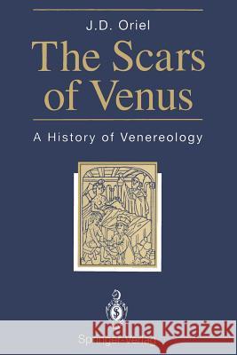 The Scars of Venus: A History of Venereology Oriel, J. David 9781447120704 Springer - książka