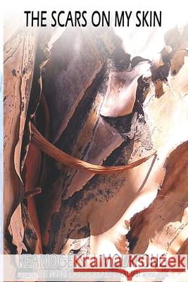 The Scars On My Skin Keamogetsi Joseph Molapong, Tee Ngugi, Joshua Razikua Kaumbi 9798608647611 Independently Published - książka