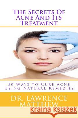 The Secrets of Acne and Its Treatment: 50 Ways to Cure Acne Using Natural Remedies Dr Lawrence Matthew 9781547212149 Createspace Independent Publishing Platform - książka