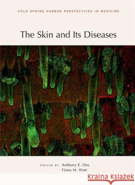 The Skin and Its Diseases Fiona M. Watt Anthony Oro 9781621820239 Cold Spring Harbor Laboratory Press - książka