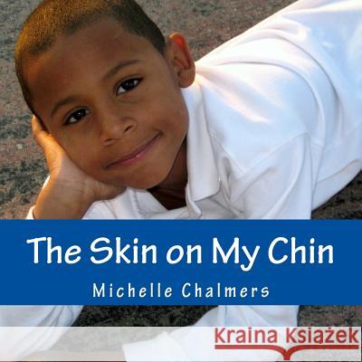 The Skin on My Chin Michelle Chalmers 9781482529838 Createspace - książka