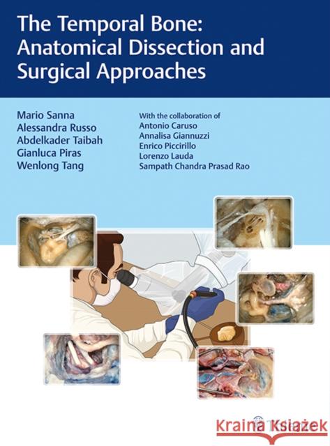 The Temporal Bone: Anatomical Dissection and Surgical Approaches Sanna, Mario 9783132419346 Tps - książka