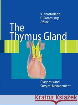 The Thymus Gland: Diagnosis and Surgical Management Anastasiadis, Kyriakos 9783642429651 Springer - książka