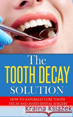 The Tooth Decay Solution: How to Naturally Cure Tooth Decay and Avoid Dental Surgery Sandi Lane 9781533243829 Createspace Independent Publishing Platform - książka