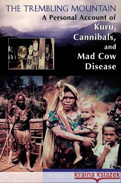 The Trembling Mountain: A Personal Account of Kuru, Cannibals, and Mad Cow Disease Klitzman, Robert 9780738206141 Perseus Publishing - książka