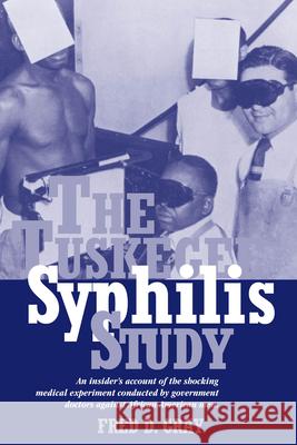 The Tuskegee Syphilis Study: An Insider's Account of the Shocking Medical Experiment Conducted by Government Doctors Against African American Men Gray, Fred 9781588380890 NewSouth Books - książka