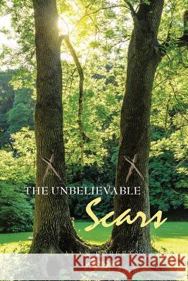 The Unbelievable Scars E Alan Roberts 9781973638438 WestBow Press - książka