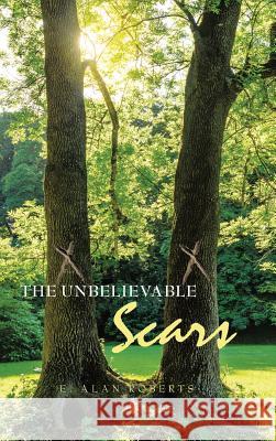 The Unbelievable Scars E Alan Roberts 9781973638445 WestBow Press - książka