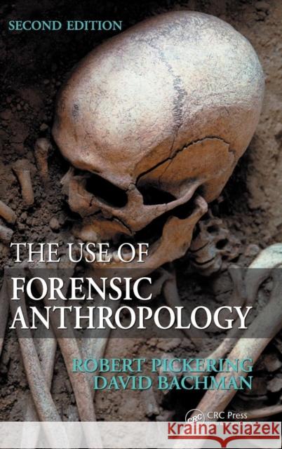 The Use of Forensic Anthropology Robert B. Pickering David Bachman 9781420068771 CRC - książka